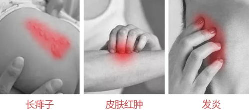 还在为蚊子嗡嗡叫影响睡眠吗 有了它,让你有个好睡眠